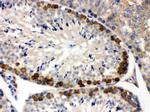 YBX1 Antibody in Immunohistochemistry (Paraffin) (IHC (P))