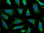 ACAA1 Antibody in Immunocytochemistry (ICC/IF)