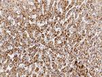 ACAA1 Antibody in Immunohistochemistry (Paraffin) (IHC (P))