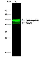 ACAA1 Antibody in Immunoprecipitation (IP)