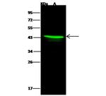 ACAA1 Antibody in Western Blot (WB)