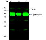 Aconitase 2 Antibody in Immunoprecipitation (IP)