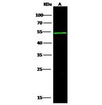 ACVR1B Antibody in Western Blot (WB)