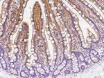 Adenosine Deaminase Antibody in Immunohistochemistry (Paraffin) (IHC (P))