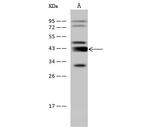 Adenosine Deaminase Antibody in Western Blot (WB)