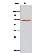 ALDH3A1 Antibody in Immunoprecipitation (IP)