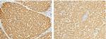 ALDH7A1 Antibody in Immunohistochemistry (Paraffin) (IHC (P))