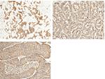 ALDH7A1 Antibody in Immunohistochemistry (Paraffin) (IHC (P))