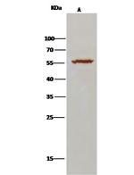 ALDH7A1 Antibody in Immunoprecipitation (IP)