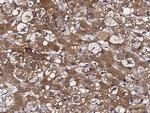 ATOX1 Antibody in Immunohistochemistry (Paraffin) (IHC (P))