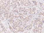 BAD Antibody in Immunohistochemistry (Paraffin) (IHC (P))