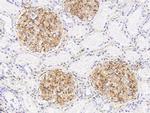 BST-2 Antibody in Immunohistochemistry (Paraffin) (IHC (P))