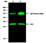 Carbonic Anhydrase II Antibody in Immunoprecipitation (IP)