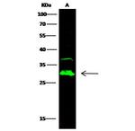 Carbonic Anhydrase II Antibody in Western Blot (WB)