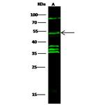 Cyclin E Antibody in Western Blot (WB)