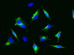 CD22 Antibody in Immunocytochemistry (ICC/IF)