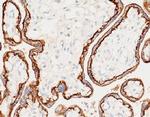 CD46 Antibody in Immunohistochemistry (Paraffin) (IHC (P))