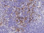 CD83 Antibody in Immunohistochemistry (Paraffin) (IHC (P))