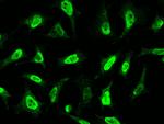 CDK4 Antibody in Immunocytochemistry (ICC/IF)