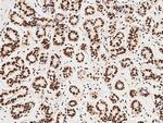 CDK4 Antibody in Immunohistochemistry (Paraffin) (IHC (P))