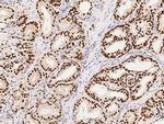 CDK4 Antibody in Immunohistochemistry (Paraffin) (IHC (P))