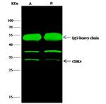 CDK4 Antibody in Immunoprecipitation (IP)