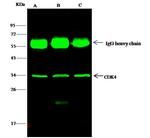 CDK4 Antibody in Immunoprecipitation (IP)