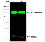 p14ARF Antibody in Immunoprecipitation (IP)