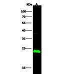 CMPK1 Antibody in Western Blot (WB)