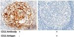 CD21 Antibody in Immunohistochemistry (Paraffin) (IHC (P))