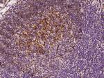 CD21 Antibody in Immunohistochemistry (Paraffin) (IHC (P))