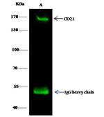 CD21 Antibody in Immunoprecipitation (IP)