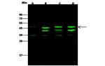 CK2 alpha-2 Antibody in Western Blot (WB)