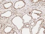 CtBP1 Antibody in Immunohistochemistry (Paraffin) (IHC (P))