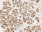 CtBP1 Antibody in Immunohistochemistry (Paraffin) (IHC (P))