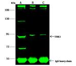 CTNNA3 Antibody in Immunoprecipitation (IP)