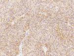 CAR Antibody in Immunohistochemistry (Paraffin) (IHC (P))