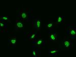 ZIPK Antibody in Immunocytochemistry (ICC/IF)