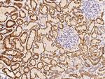 DECR1 Antibody in Immunohistochemistry (Paraffin) (IHC (P))