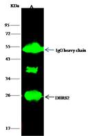 DHRS2 Antibody in Immunoprecipitation (IP)