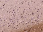 DKK3 Antibody in Immunohistochemistry (Paraffin) (IHC (P))