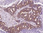 DKK3 Antibody in Immunohistochemistry (Paraffin) (IHC (P))