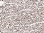 RCAS1 Antibody in Immunohistochemistry (Paraffin) (IHC (P))