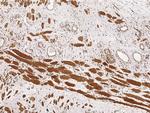 RCAS1 Antibody in Immunohistochemistry (Paraffin) (IHC (P))