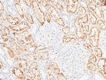 ENTPD5 Antibody in Immunohistochemistry (Paraffin) (IHC (P))