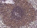 ETV5 Antibody in Immunohistochemistry (Paraffin) (IHC (P))