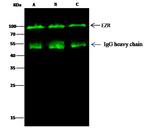 Ezrin Antibody in Immunoprecipitation (IP)