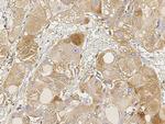 FUT4 Antibody in Immunohistochemistry (Paraffin) (IHC (P))