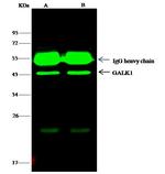 GALK1 Antibody in Immunoprecipitation (IP)