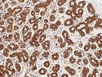 PIST Antibody in Immunohistochemistry (Paraffin) (IHC (P))